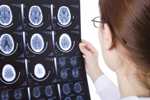 Doctor Examining An X-ray Stock Photo